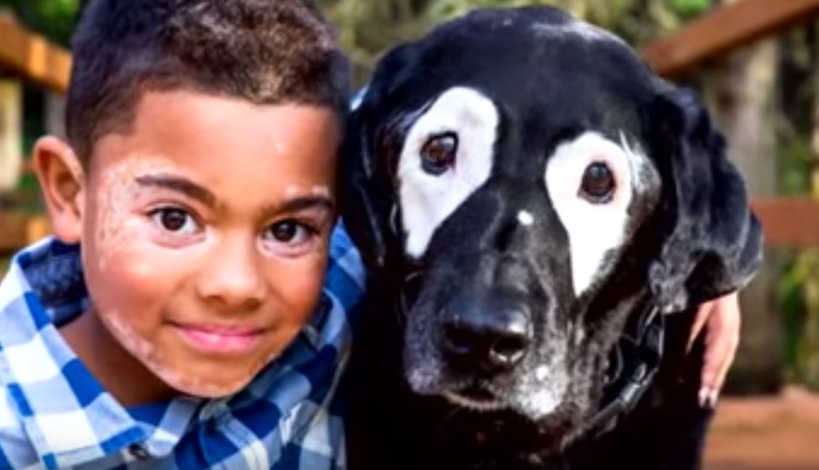 Gehänselter Junge lernt einen Hund mit der gleichen Hautkrankheit kennen